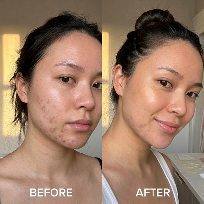 ByLux™ Hyperpigmentation Patch • Glutathione, Niacinamide & NAG